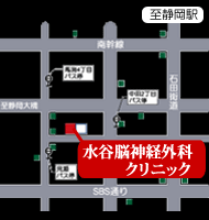 頭蓋骨骨折 静岡市 水谷脳神経外科クリニック 駿河区